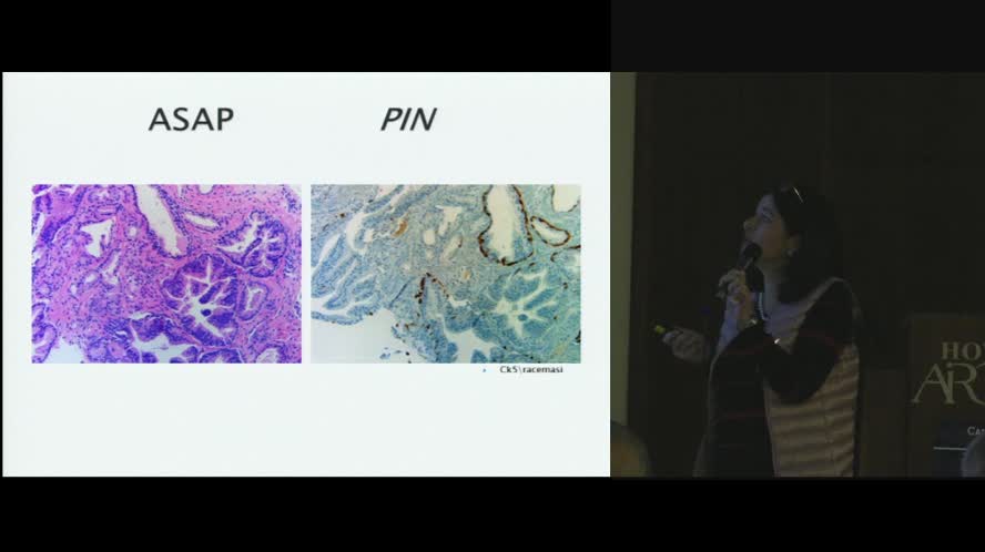 Agobiopsia della prostata