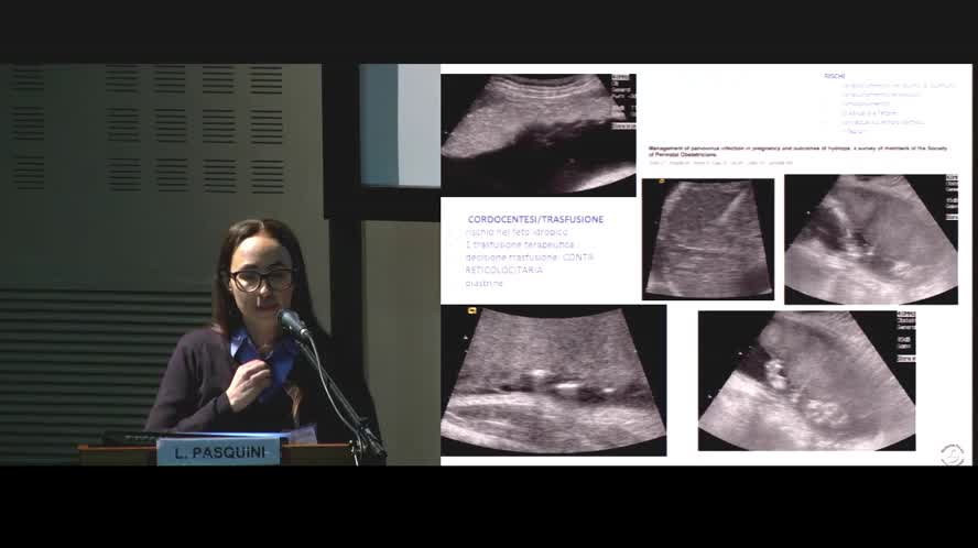 Parvovirus B19 ruolo  della Diagnostica Prenatale