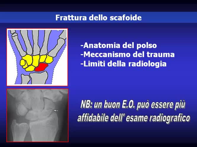 Trabocchetti nel trauma della mano