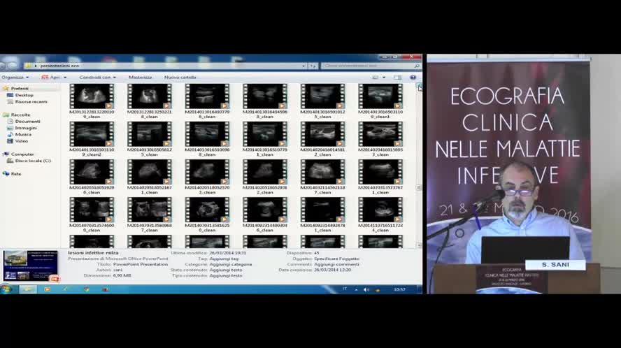 Milza e linfonodi Il paziente ematologico