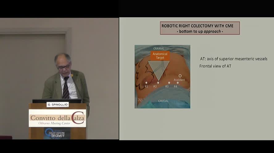Robotic CME with suprapubic access