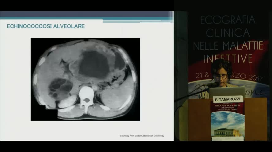 Ecografia nelle parassitosi
