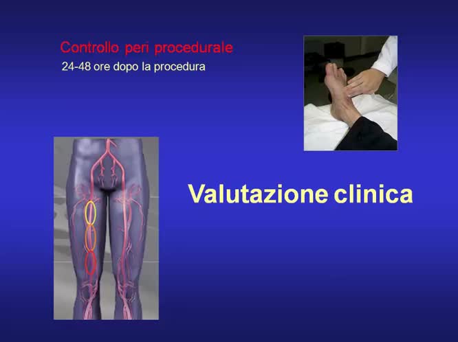 Ecodoppler vascolare in emergenza