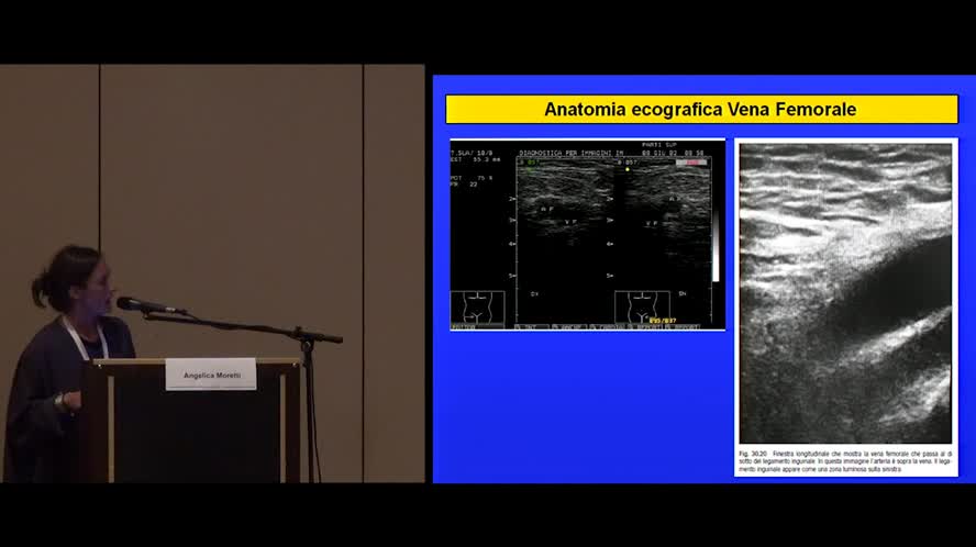 Anatomia ecografica e scelta della sede di posizionamento di CVC/PICC/Midline