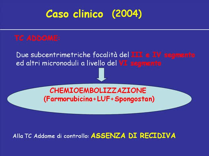 Recidiva di HCC post trapianto trattamenti multipli
