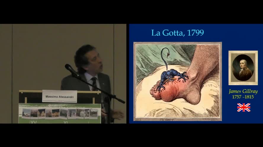 Trattamento della iperuricemia