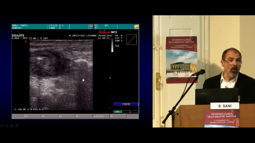 Casi clinici: Lesioni focali epatospleniche in AIDS Lesioni infettive della milza