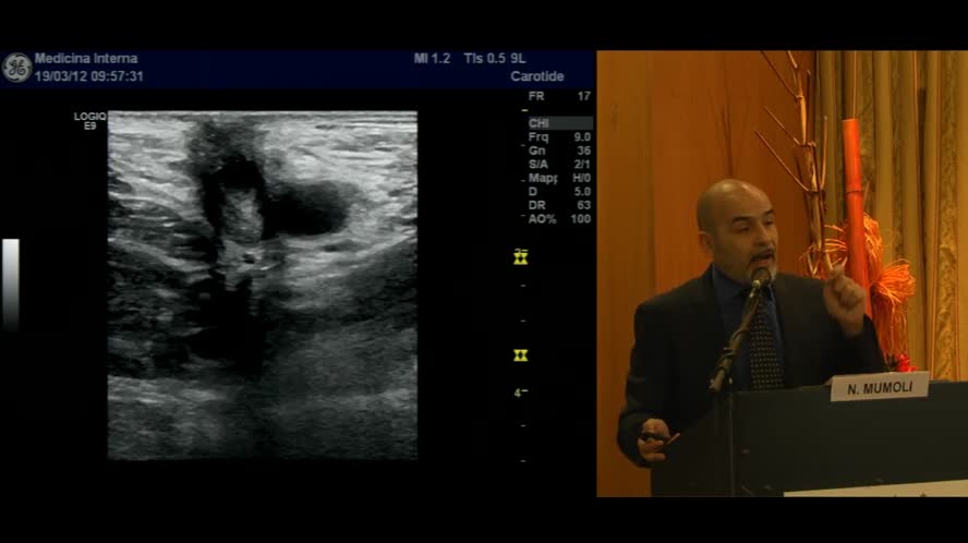 L'ecografo come estensione dell'esame obbiettivo nelle malattie vascolari