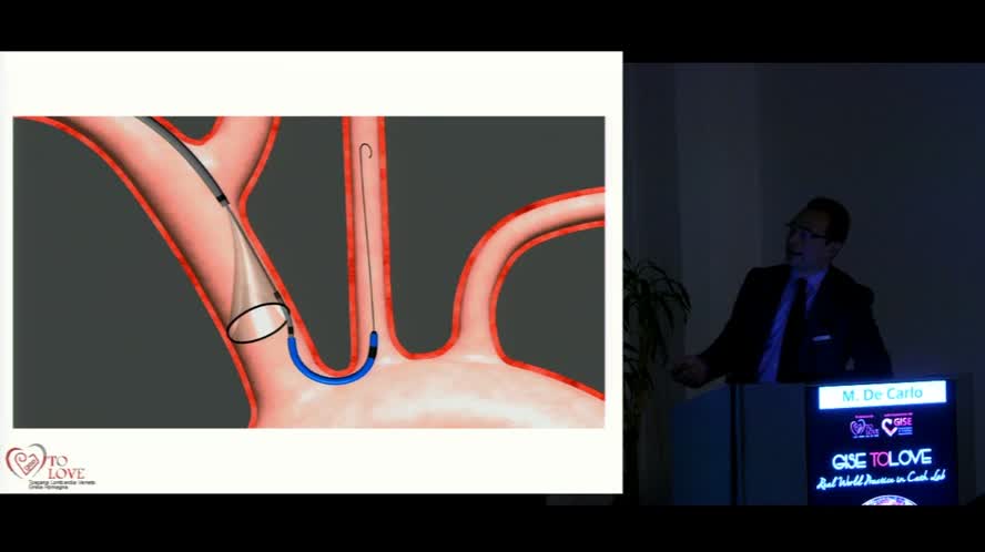 TAVI Corevalve Evolut R