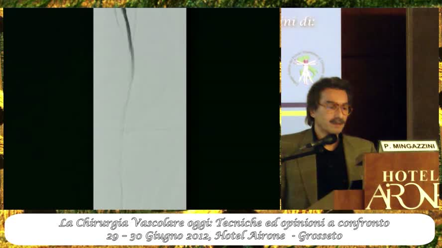 Tecniche endovascolari di rivascolarizzazione retrograda degli assi femoro-popliteo-tibiali