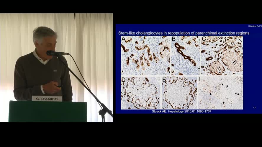 Ipertensione portale una strada senza ritorno