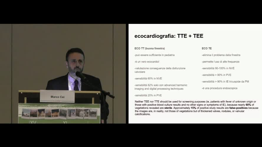 Endocardite infettiva