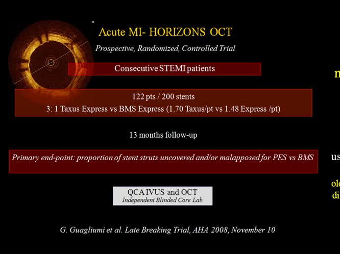 Stents medicati cosa c e sicuro cosa c'è di nuovo