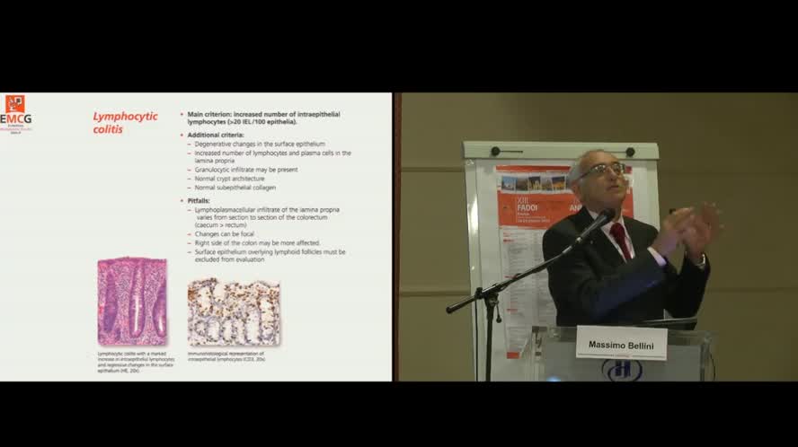 Coliti di interesse per l'Internista: la colite microscopica