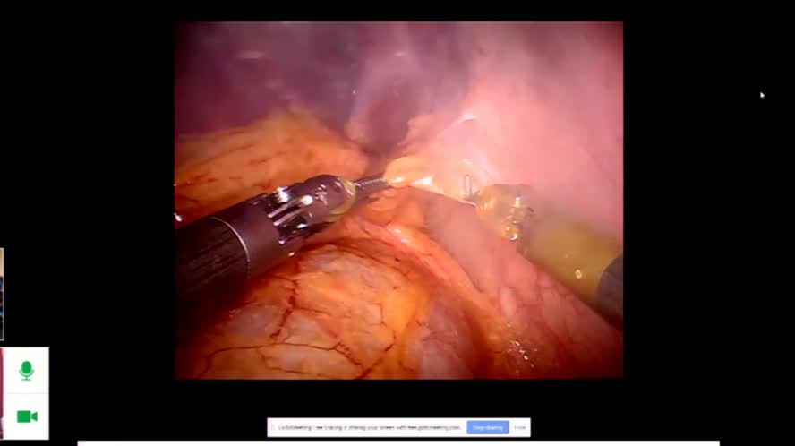 Video Conference from Chicago, USA The operating room of the future