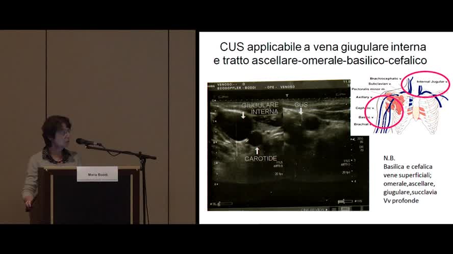 Prevenzione, diagnosi e gestione delle complicanze trombotiche