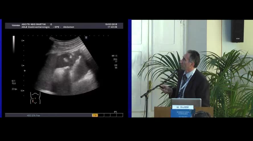 Paracentesi corretto uso ed apporto dell'ecografia