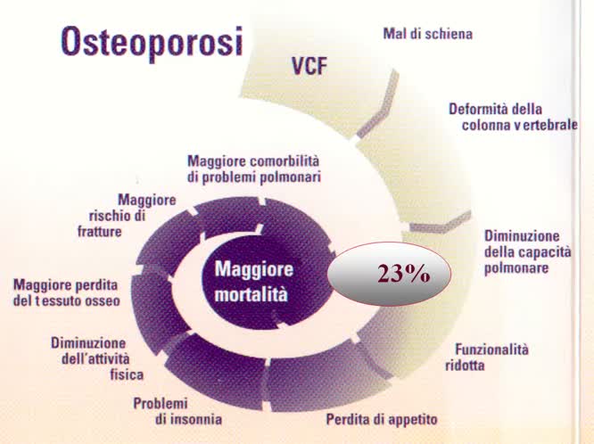 Le fratture da fragilita e trattamento farmacologico dell osteoporosi