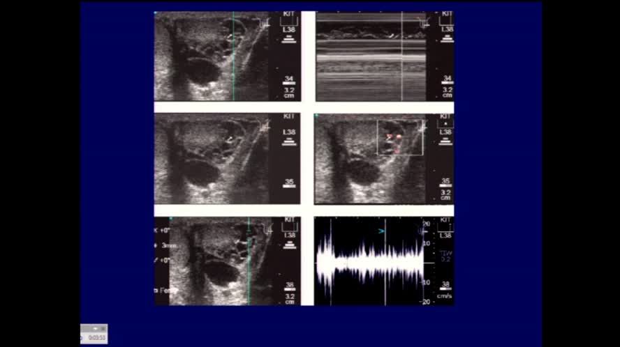 Ecografia nelle parassitosi