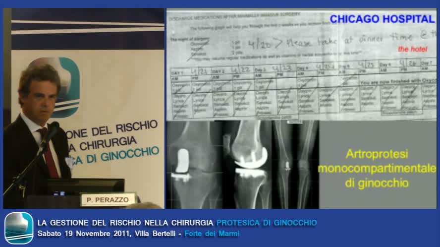 Update e valori dell'approccio analgesico multimodale in chirurgia maggiore di ginocchio