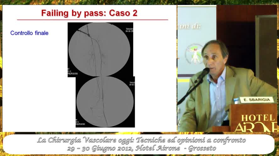Insuccessi multipli delle rivascolarizzazioni periferiche i bypass ripetuti sono giustificati?