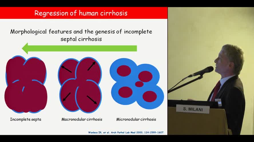 Reversione della fibrosi nel paziente trattato