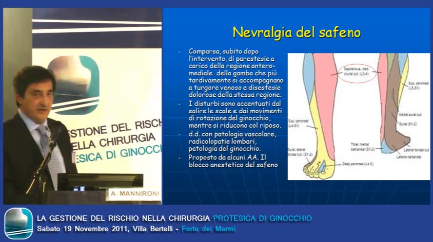 La diagnostica delle lesioni nervose dopo chirurgia di ginocchio