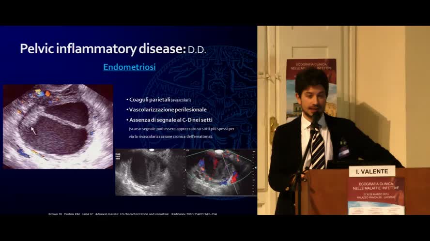 Pelvic inflammatory disease