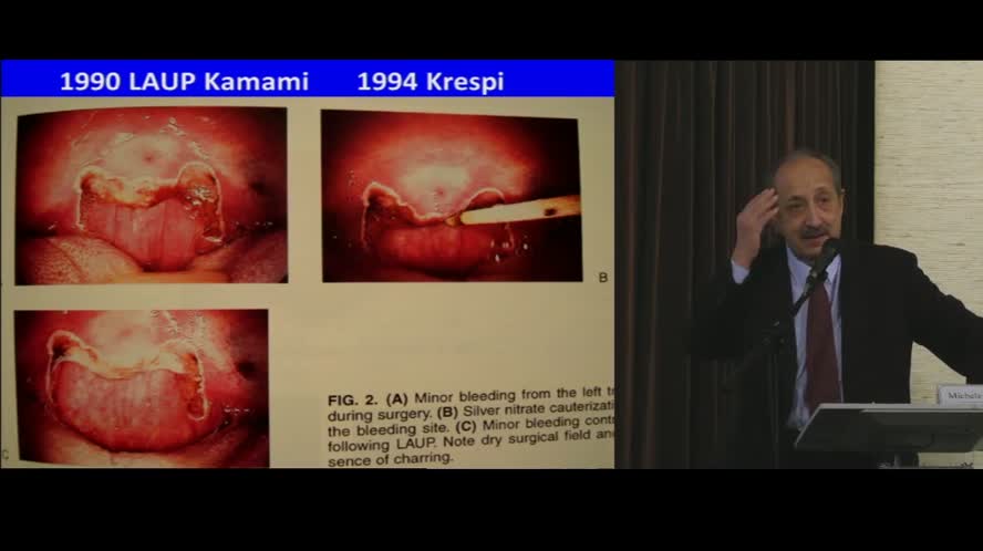 Evoluzione della chirurgia orofaringea / palatale