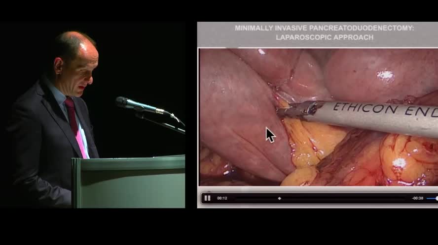 Minimally invasive pancreatoduodenectomy: robotic vs laparoscopic approach