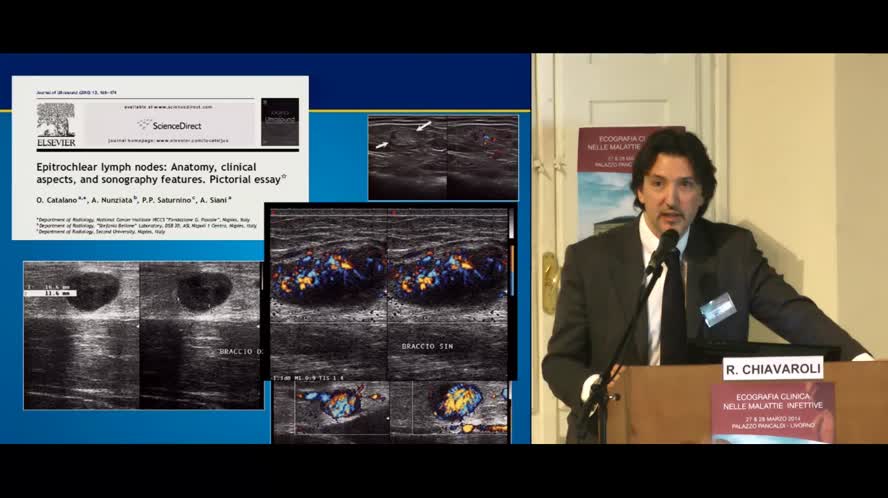 Diagnostica ecografica nelle linfoadenopatie infettive e nelle sindromi mononucleosiche