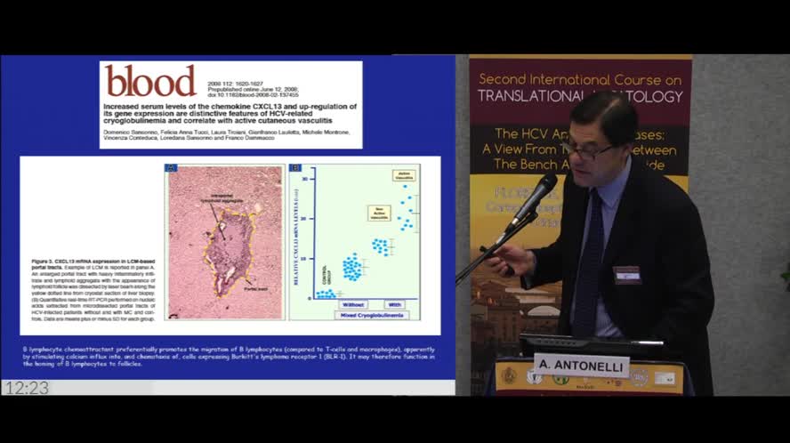 The emerging role of cytokines in determining the natural history of HCV disease