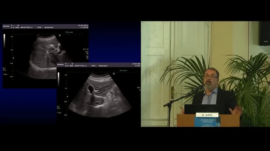 Ruolo dell'ecografia nella gestione del paziente con epatopatia acuta