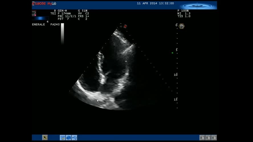LIVE Ecocardiogramma