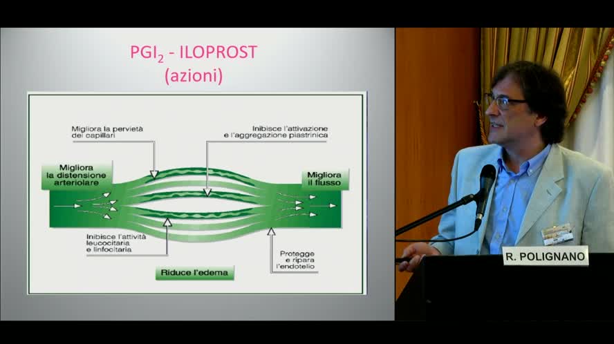 Terapia medica della CLI fino alla domiciliazione dei prostanoidi