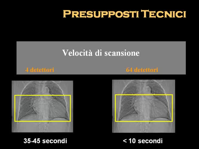 Il futuro dell imaging coronarico non invasivo o intravascolare